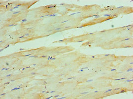 Immunohistochemistry of paraffin-embedded human skeletal muscle tissue using CSB-PA859111ESR1HU at dilution of 1:100