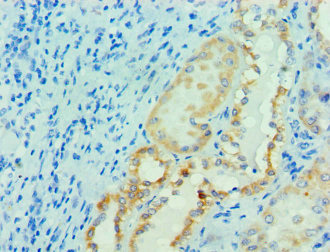 Immunohistochemistry of paraffin-embedded human kidney tissue using CSB-PA859113ESR1HU at dilution of 1:100