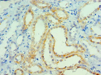 Immunohistochemistry of paraffin-embedded human kidney tissue using CSB-PA859113ESR2HU at dilution of 1:100