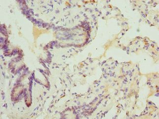 Immunohistochemistry of paraffin-embedded human lung tissue using CSB-PA859942ESR1HU at dilution of 1:100
