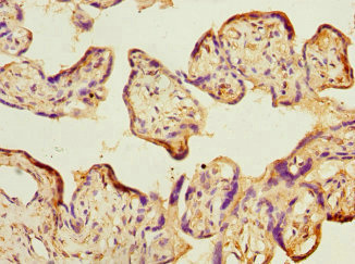 Immunohistochemistry of paraffin-embedded human placenta tissue using CSB-PA860770ESR1HU at dilution of 1:100