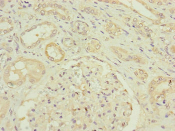 Immunohistochemistry of paraffin-embedded human kidney tissue using CSB-PA863116ESR2HU at dilution of 1:100