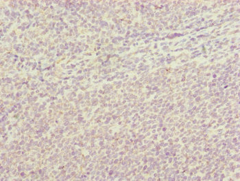 Immunohistochemistry of paraffin-embedded human tonsil tissue using CSB-PA863116ESR2HU at dilution of 1:100