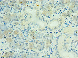 Immunohistochemistry of paraffin-embedded human pancreatic tissue using CSB-PA865108ESR2HU at dilution of 1:100