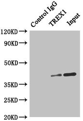 Immunoprecipitating TREX1 in Hela whole cell lysate Lane 1: Rabbit control IgG instead of (1microg) instead of CSB-PA865133ESR1HU in Hela whole cell lysate. For western blotting, a HRP-conjugated anti-rabbit IgG, specific to the non-reduced form of IgG was used as the Secondary antibody (1/50000) Lane 2: CSB-PA865133ESR1HU (4microg) + Hela whole cell lysate (500microg) Lane 3: Hela whole cell lysate (20microg)