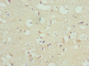 Immunohistochemistry of paraffin-embedded human brain tissue using CSB-PA866298DSR1HU at dilution of 1:100