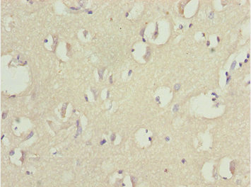 Immunohistochemistry of paraffin-embedded human brain tissue using CSB-PA874802ESR2HU at dilution of 1:100