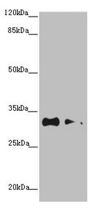 Western blot All lanes: CNPY3 antibody at 1.2microg/ml Lane 1: HepG2 whole cell lysate Lane 2: MCF-7 whole cell lysate Secondary Goat polyclonal to rabbit IgG at 1/10000 dilution Predicted band size: 31, 6 kDa Observed band size: 31 kDa Western blot All lanes: CNPY3 antibody at 1.2microg/ml Lane 1: HepG2 whole cell lysate Lane 2: MCF-7 whole cell lysate Secondary Goat polyclonal to rabbit IgG at 1/10000 dilution Predicted band size: 31, 6 kDa Observed band size: 31 kDa