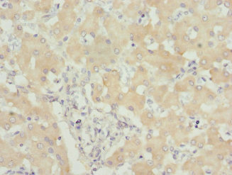 Immunohistochemistry of paraffin-embedded human liver tissue using CSB-PA874835ESR1HU at dilution of 1:100