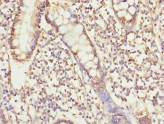 Immunohistochemistry of paraffin-embedded human small intestine tissue using CSB-PA874835ESR1HU at dilution of 1:100