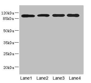 Western blot All lanes: USP26 antibody at 5.22microg/ml Lane 1: Hela whole cell lysate Lane 2: U937 whole cell lysate Lane 3: Mouse gonadal tissue Lane 4: Mouse liver tissue Secondary Goat polyclonal to rabbit IgG at 1/10000 dilution Predicted band size: 105 kDa Observed band size: 105 kDa
