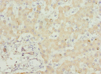 Immunohistochemistry of paraffin-embedded human liver tissue using CSB-PA874835ESR2HU at dilution of 1:100