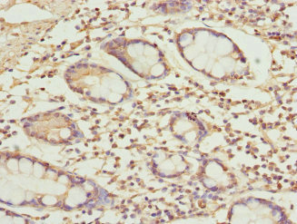 Immunohistochemistry of paraffin-embedded human small intestine tissue using CSB-PA874835ESR2HU at dilution of 1:100
