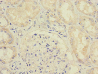 Immunohistochemistry of paraffin-embedded human kidney tissue using CSB-PA875672ESR1HU at dilution of 1:100
