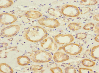Immunohistochemistry of paraffin-embedded human kidney tissue using CSB-PA875672ESR2HU at dilution of 1:100