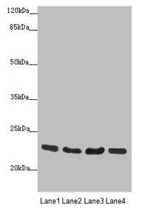 CSB-PA878835ESR1HU