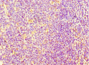 Immunohistochemistry of paraffin-embedded human tonsil tissue using CSB-PA880129ESR1HU at dilution of 1:100