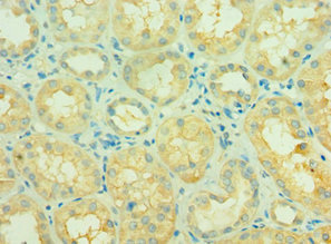 Immunohistochemistry of paraffin-embedded human kidney tissue using CSB-PA882102ESR1HU at dilution of 1:100
