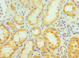 Immunohistochemistry of paraffin-embedded human kidney tissue using CSB-PA882102ESR2HU at dilution of 1:100