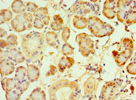 Immunohistochemistry of paraffin-embedded human pancreatic tissue using CSB-PA882102ESR2HU at dilution of 1:100