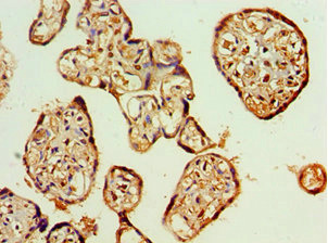 Immunohistochemistry of paraffin-embedded human placenta tissue using CSB-PA882159ESR1HU at dilution of 1:100
