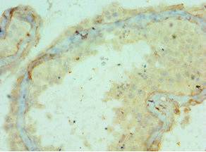 Immunohistochemistry of paraffin-embedded human testis tissue using CSB-PA889097ESR1HUat dilution of 1:100 Immunohistochemistry of paraffin-embedded human testis tissue using CSB-PA889097ESR1HUat dilution of 1:100