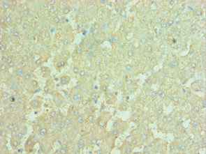 Immunohistochemistry of paraffin-embedded human liver tissue using CSB-PA889097ESR1HUat dilution of 1:100