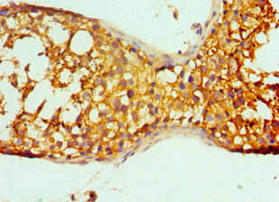 CSB-PA890741ESR1HU
