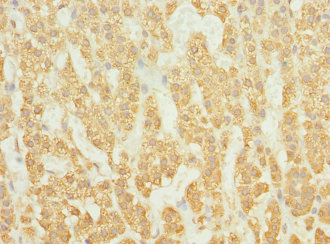 Immunohistochemistry of paraffin-embedded human adrenal gland tissue using CSB-PA891960ESR1HU at dilution of 1:100
