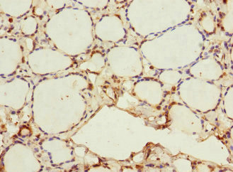 Immunohistochemistry of paraffin-embedded human thyroid tissue using CSB-PA896500ESR1HU at dilution of 1:100