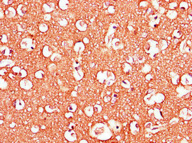 Immunohistochemistry of paraffin-embedded human brain tissue using CSB-PA001377LA01HU at dilution of 1:100