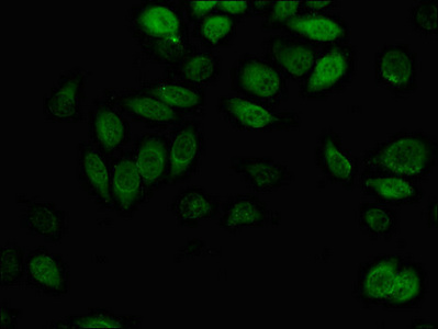 Immunofluorescent analysis of A549 cells using CSB-PA001539LA01HU at dilution of 1:100 and Alexa Fluor 488-congugated AffiniPure Goat Anti-Rabbit IgG(H+L)