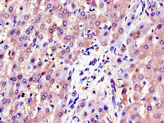 Immunohistochemistry of paraffin-embedded human liver tissue using CSB-PA001539LA01HU at dilution of 1:100