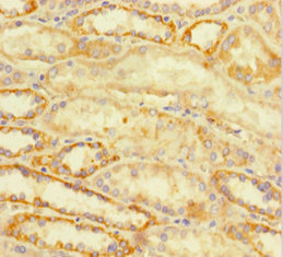 CSB-PA002437LA01HU