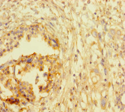 CSB-PA002437LA01HU