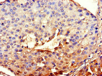 CSB-PA002691LA01HU
