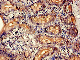 Immunohistochemistry of paraffin-embedded human small intestine tissue using CSB-PA00359A0Rb at dilution of 1:100 Immunohistochemistry of paraffin-embedded human small intestine tissue using CSB-PA00359A0Rb at dilution of 1:100