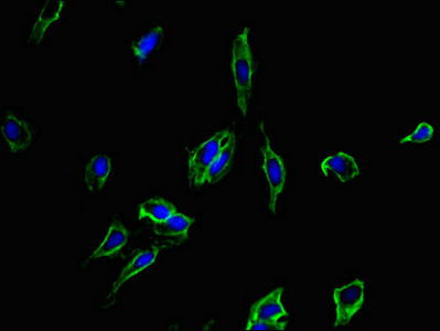 Immunofluorescence(IF) - CD40 Antibody