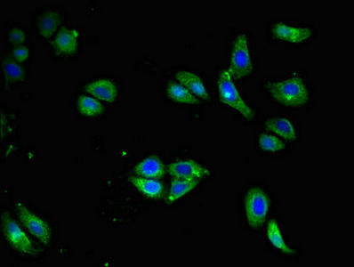 Immunofluorescence(IF) - CD79A Antibody