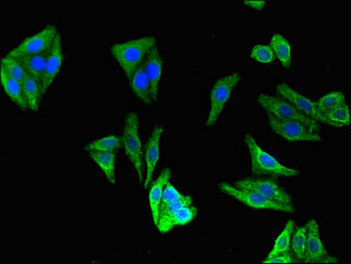 Immunofluorescent analysis of HepG2 cells using CSB-PA005256LA01HU at dilution of 1:100 and Alexa Fluor 488-congugated AffiniPure Goat Anti-Rabbit IgG(H+L)