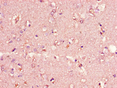Immunohistochemistry of paraffin-embedded human brain tissue using CSB-PA005431LA01HU at dilution of 1:100