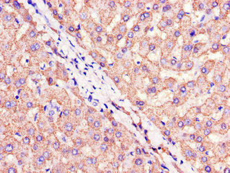 Immunohistochemistry of paraffin-embedded human liver tissue using CSB-PA005431LA01HU at dilution of 1:100