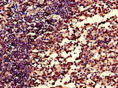 Immunohistochemistry of paraffin-embedded human tonsil tissue using CSB-PA005932EA01HU at dilution of 1:100