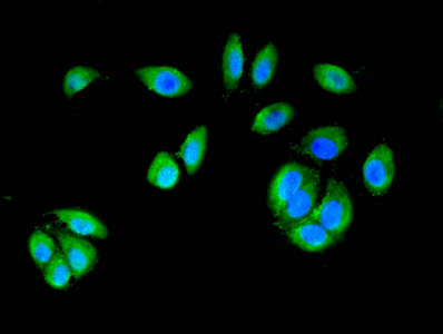 Immunofluorescence(IF) - CTNND1 Antibody