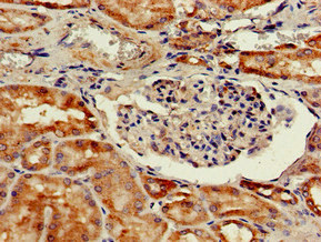 Immunohistochemistry of paraffin-embedded human kidney tissue using CSB-PA006191LA01HU at dilution of 1:100