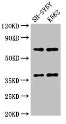 Western Blot Positive WB detected in: SH-SY5Y whole cell lysate, K562 whole cell lysate All lanes: CTSH antibody at 2.7microg/ml Secondary Goat polyclonal to rabbit IgG at 1/50000 dilution Predicted band size: 38 kDa Observed band size: 38 kDa Western Blot Positive WB detected in: SH-SY5Y whole cell lysate, K562 whole cell lysate All lanes: CTSH antibody at 2.7microg/ml Secondary Goat polyclonal to rabbit IgG at 1/50000 dilution Predicted band size: 38 kDa Observed band size: 38 kDa