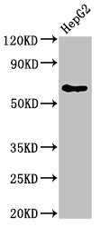 Western Blotting(WB) - DLAT Antibody