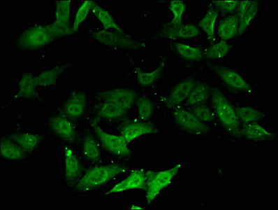 Immunofluorescent analysis of Hela cells using CSB-PA007116LA01HU at dilution of 1:100 and Alexa Fluor 488-congugated AffiniPure Goat Anti-Rabbit IgG(H+L)