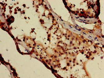 Immunohistochemistry of paraffin-embedded human testis tissue using CSB-PA007116LA01HU at dilution of 1:100 Immunohistochemistry of paraffin-embedded human testis tissue using CSB-PA007116LA01HU at dilution of 1:100