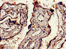 Immunohistochemistry of paraffin-embedded human placenta tissue using CSB-PA007405LA01HU at dilution of 1:100